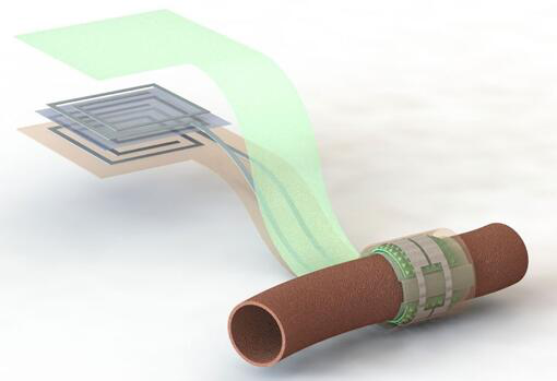 斯坦福大學(xué)開(kāi)發(fā)新型可降解血流傳感器?可檢查血管是否堵塞