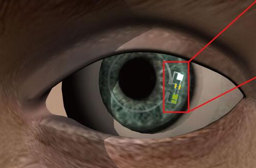 谷歌之后，又來一款血糖傳感智能隱形眼鏡